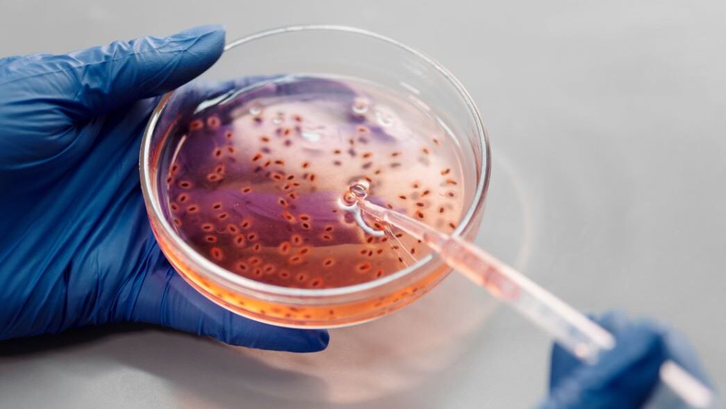 Manos con guantes sosteniendo una placa de Petri con líquido y una pipeta.